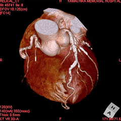 心臓3D画像